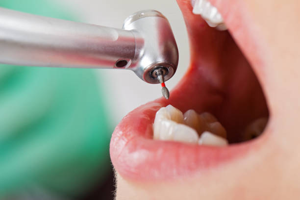 Best Pediatric Emergency Dentist in Manawa, WI